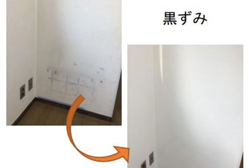 黒ずみ